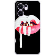 Чохол BoxFace OPPO Reno 14 F 