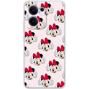 Чохол BoxFace OPPO Reno 14 F 