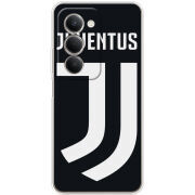 Чохол BoxFace Xiaomi Redmi 15 171 mm FC J