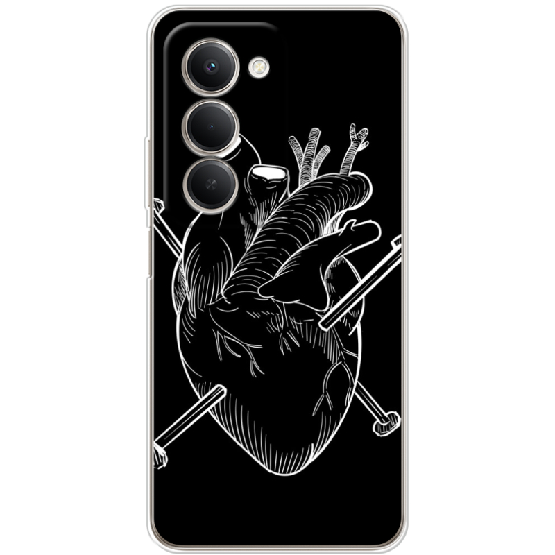 Чохол BoxFace Xiaomi Redmi 15 171 mm 