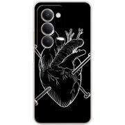 Чохол BoxFace Xiaomi Redmi 15 171 mm 