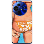 Чохол BoxFace TCL 50 Pro NxtPaper 5G 