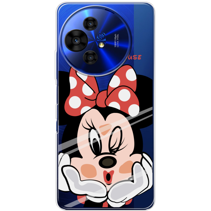 Прозорий чохол BoxFace TCL 50 Pro NxtPaper 5G Lady M