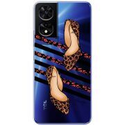 Прозорий чохол BoxFace TCL 505 Love Beauty