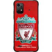 Чохол BoxFace Umidigi Bison X20 