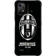 Чохол BoxFace Umidigi Bison X20 