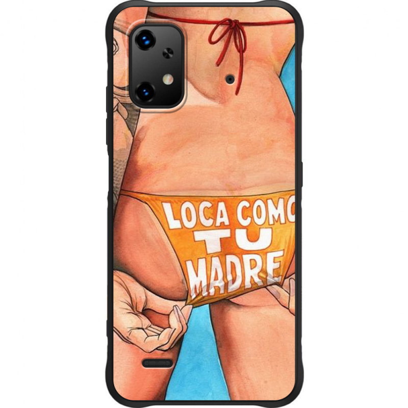 Чохол BoxFace Umidigi Bison X20 