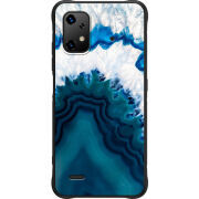 Чохол BoxFace Umidigi Bison X20 