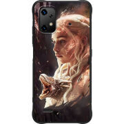 Чохол BoxFace Umidigi Bison X20 