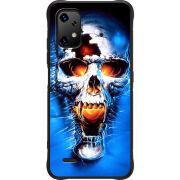 Чохол BoxFace Umidigi Bison X20 