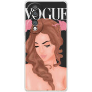 Чохол BoxFace Honor 70 Fashion Girl