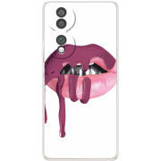 Чохол BoxFace Honor 70 