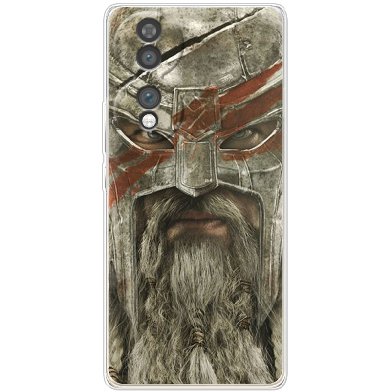 Чохол BoxFace Honor 70 
