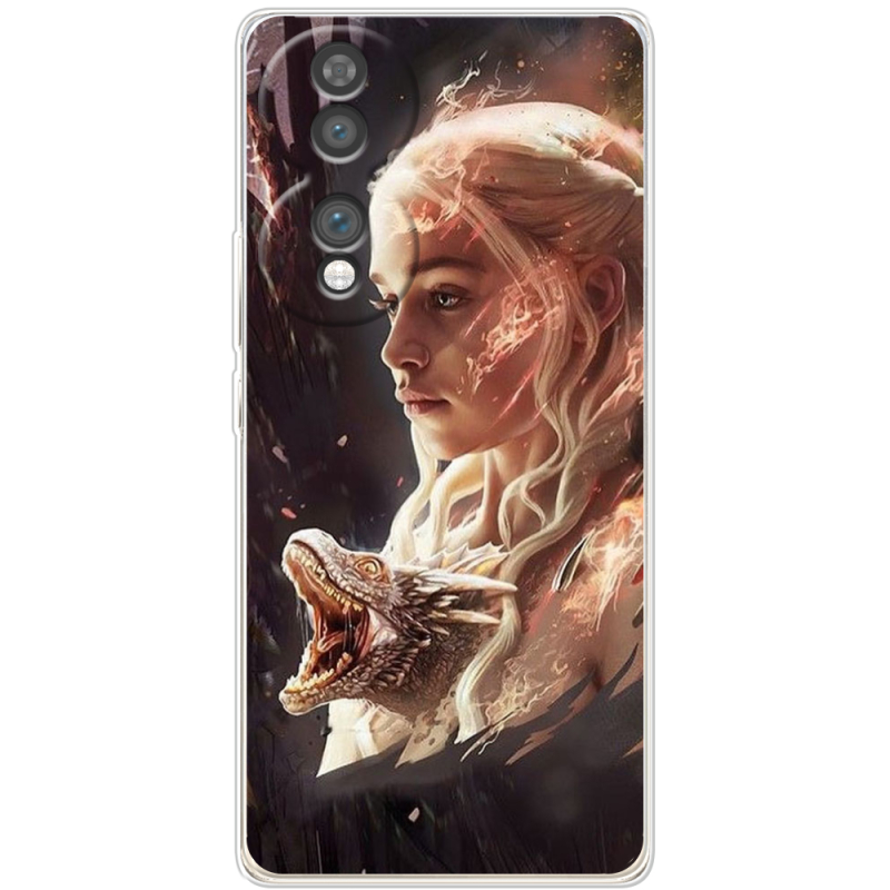 Чохол BoxFace Honor 70 