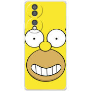 Чохол BoxFace Honor 70 