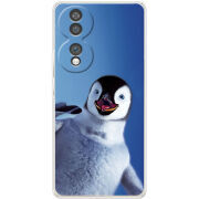 Чохол BoxFace Honor 70 