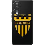 Чорний чохол BoxFace Honor 70 