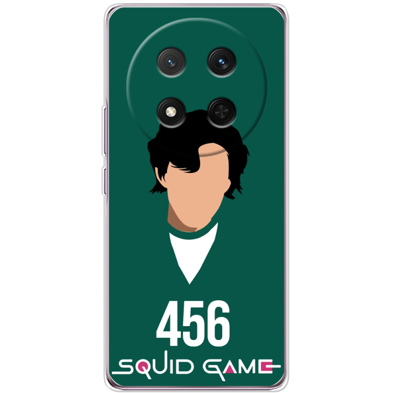 Чохол BoxFace Honor Magic 7 Lite 5G siquid game 456