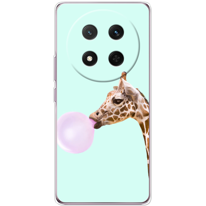 Чохол BoxFace Honor Magic 7 Lite 5G 