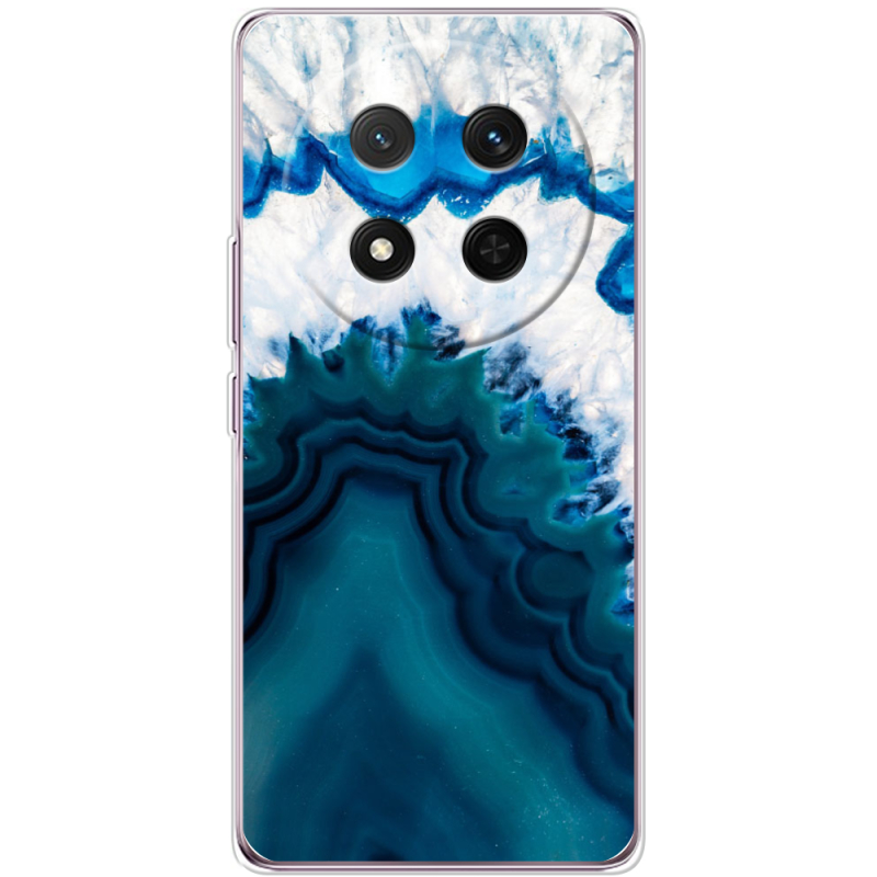 Чохол BoxFace Honor Magic 7 Lite 5G 