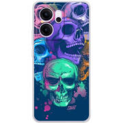 Чохол BoxFace OPPO Reno 14 F 