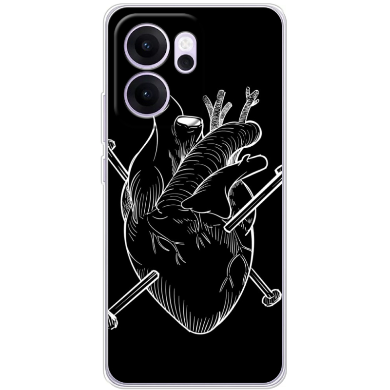 Чохол BoxFace OPPO Reno 14 F 