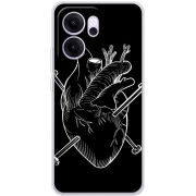 Чохол BoxFace OPPO Reno 14 F 