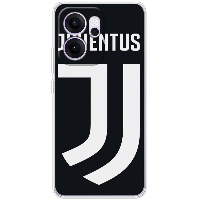 Чохол BoxFace OPPO Reno 14 FS FC J