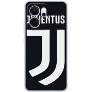 Чохол BoxFace OPPO Reno 14 FS FC J