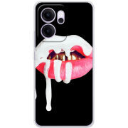 Чохол BoxFace OPPO Reno 14 FS 