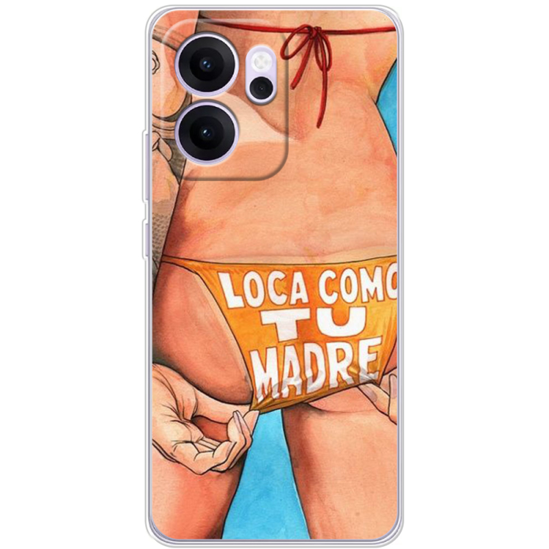 Чохол BoxFace OPPO Reno 14 FS 