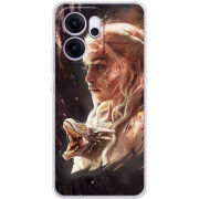 Чохол BoxFace OPPO Reno 14 FS 