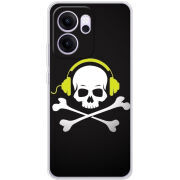 Чохол BoxFace OPPO Reno 14 FS 