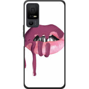 Чохол BoxFace TCL 40 NxtPaper 5G 