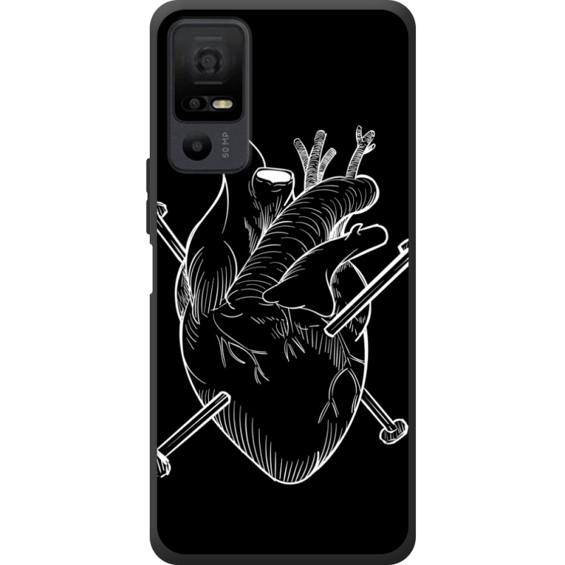 Чохол BoxFace TCL 40 NxtPaper 5G 