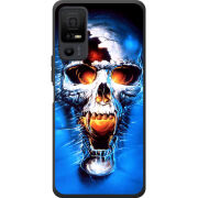 Чохол BoxFace TCL 40 NxtPaper 5G 