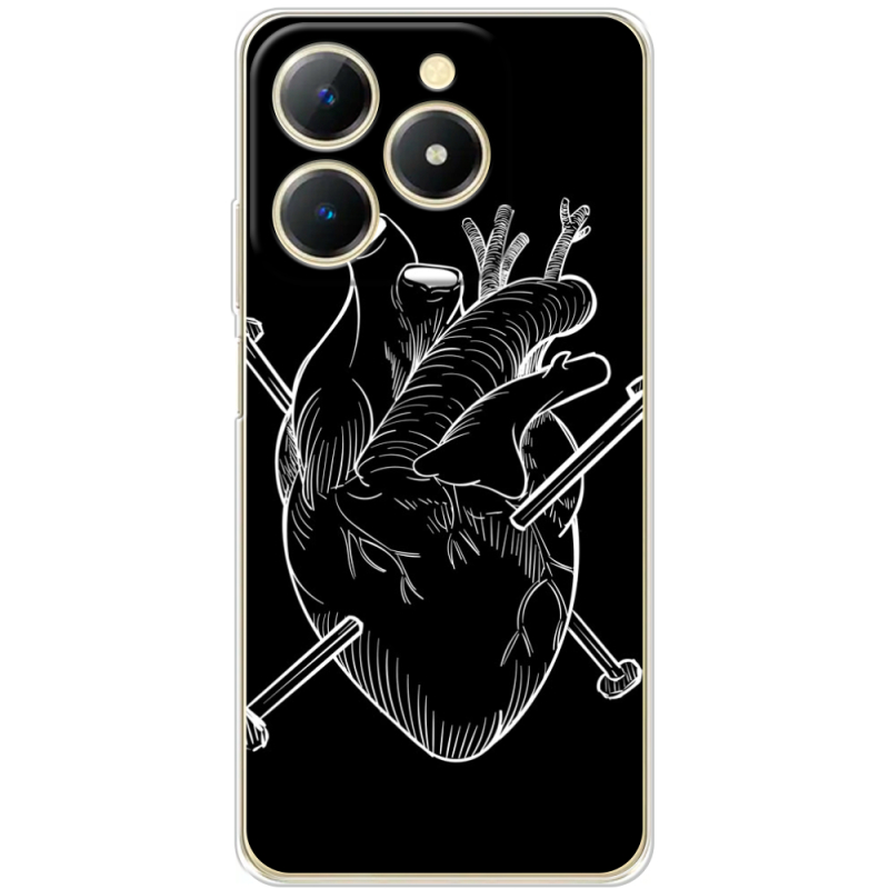 Чохол BoxFace Realme Note 70