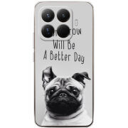 Чохол BoxFace Xiaomi 15T Pro 