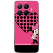 Чохол BoxFace Xiaomi 15T Pro 