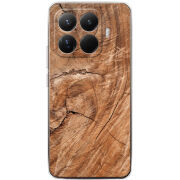 Чохол BoxFace Xiaomi 15T Pro 