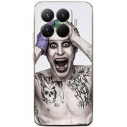 Чохол BoxFace Xiaomi 15T Pro 