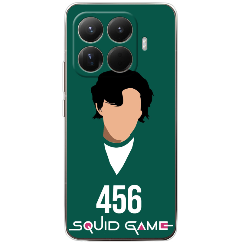 Чохол BoxFace Xiaomi 15T Pro siquid game 456