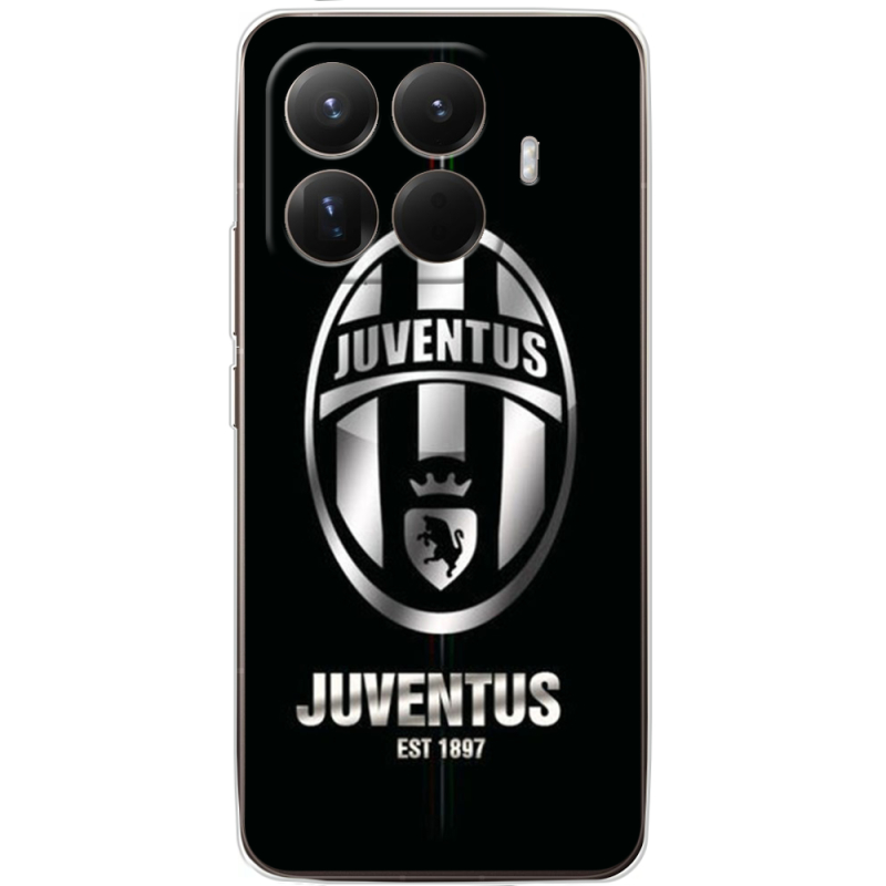 Чохол BoxFace Xiaomi 15T Pro