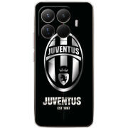 Чохол BoxFace Xiaomi 15T Pro 