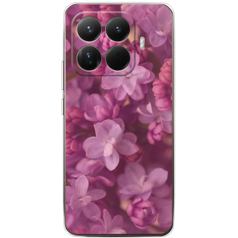 Чохол BoxFace Xiaomi 15T Pro