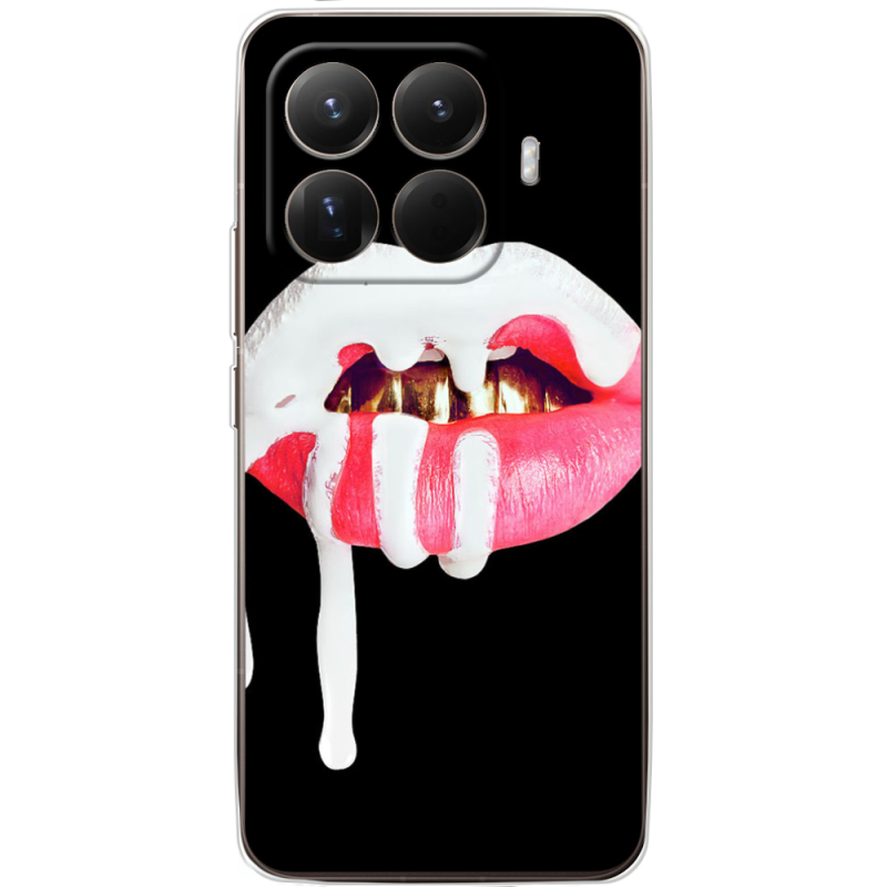 Чохол BoxFace Xiaomi 15T Pro