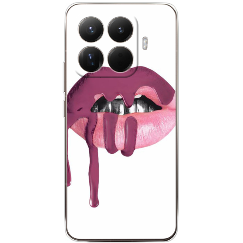 Чохол BoxFace Xiaomi 15T Pro