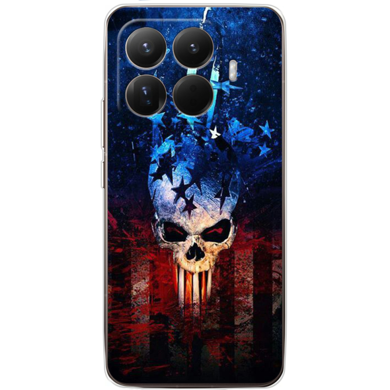 Чохол BoxFace Xiaomi 15T Pro