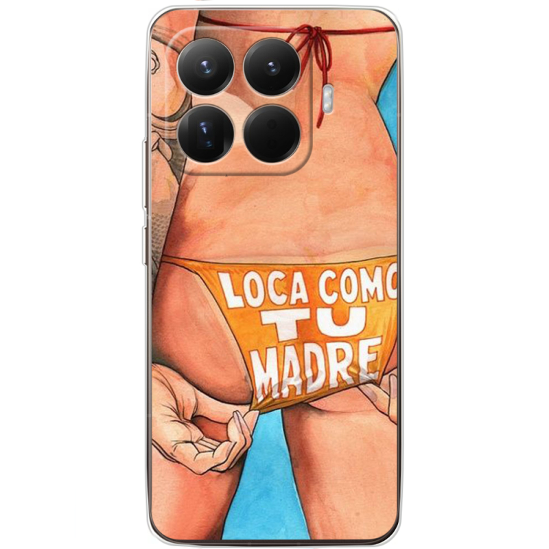 Чохол BoxFace Xiaomi 15T Pro