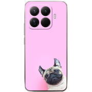 Чохол BoxFace Xiaomi 15T Pro 